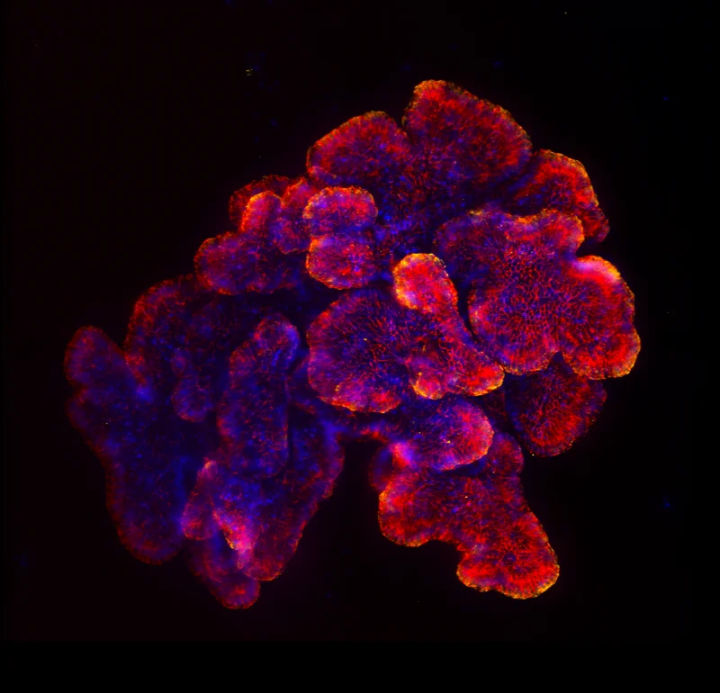 Human lung organoid.webp