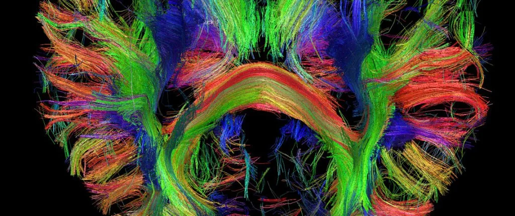 cps gehirnaufnahme bunt_DZNE.jpg