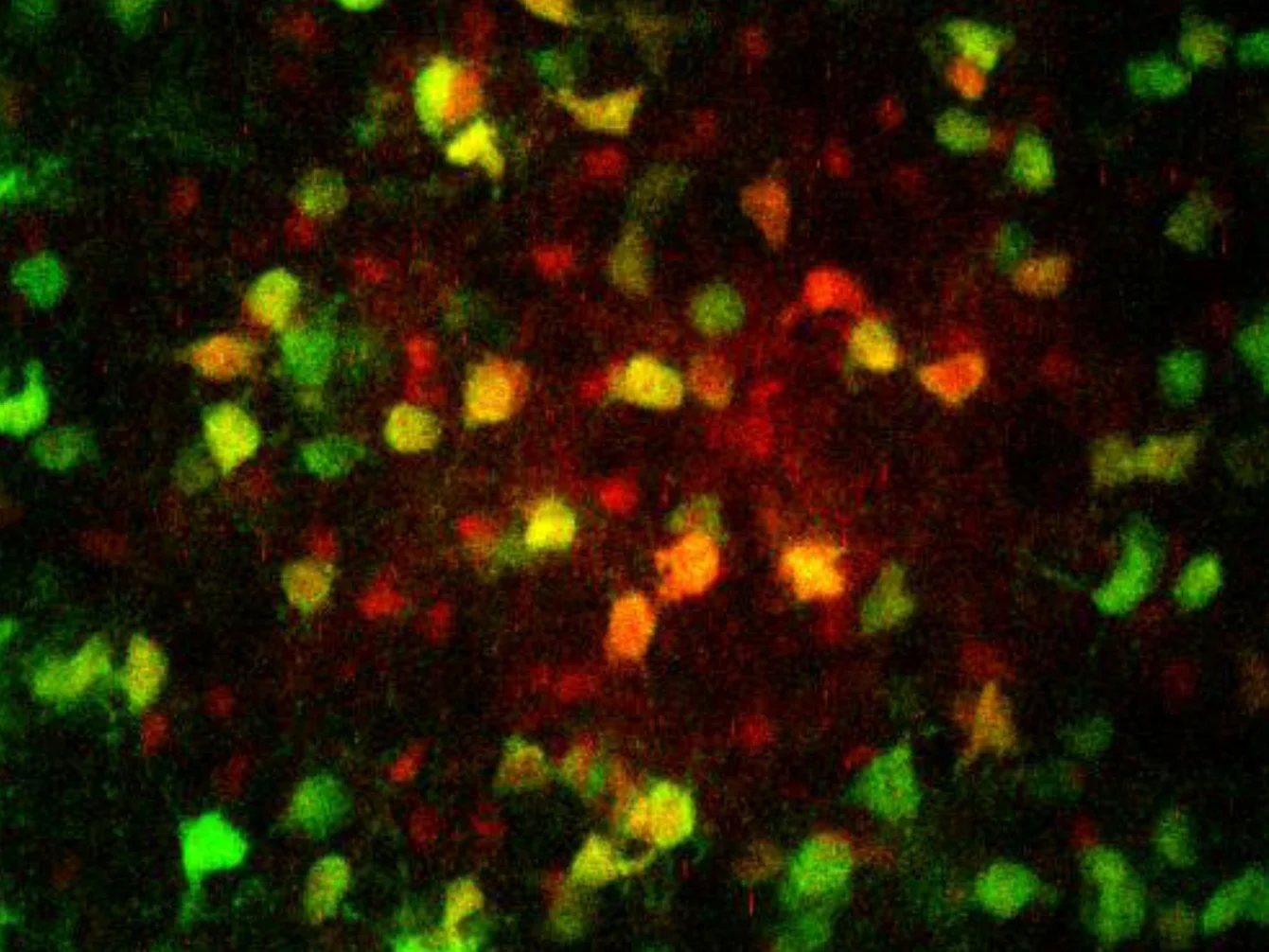 Hirnzell-Netzwerk versorgt Neuronen mit Energie
