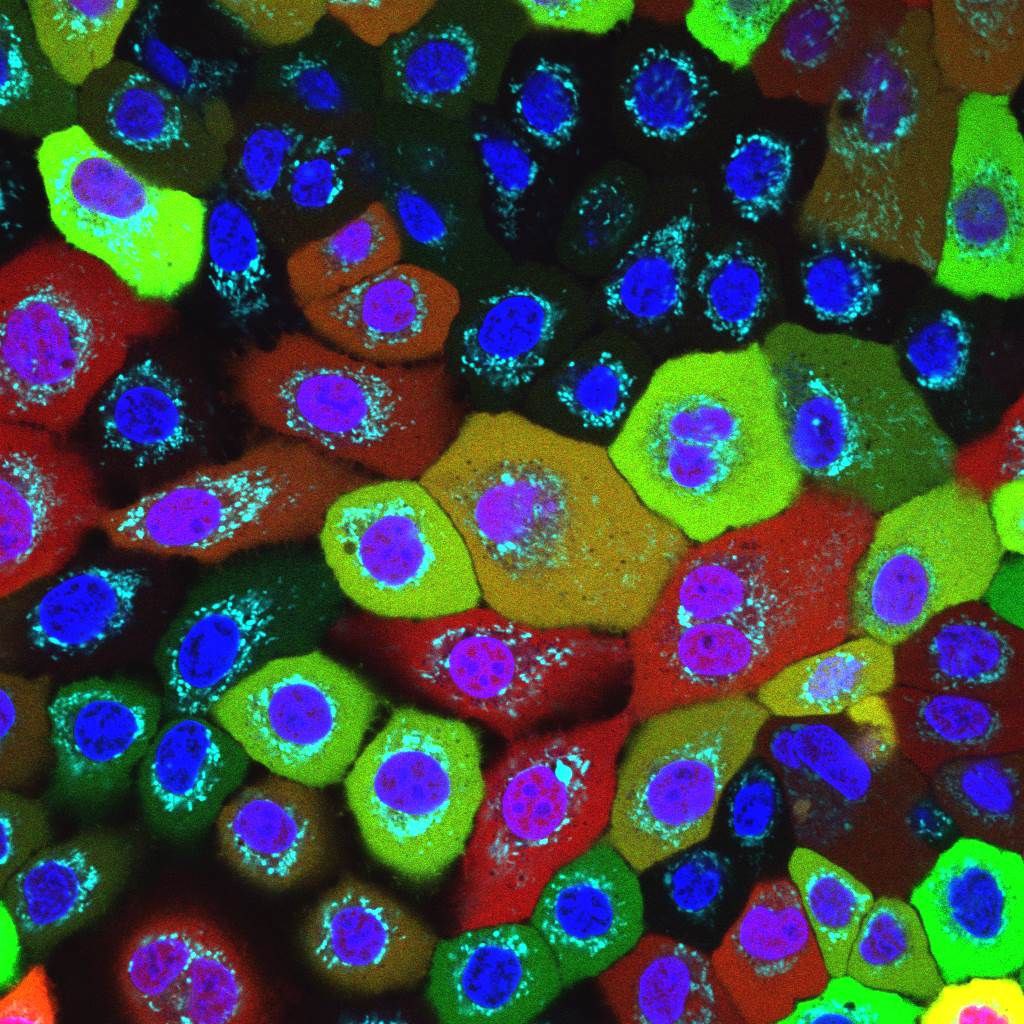 Hautzellen des Menschen mit „gesunden“ Mitochondrien (hellblau):
