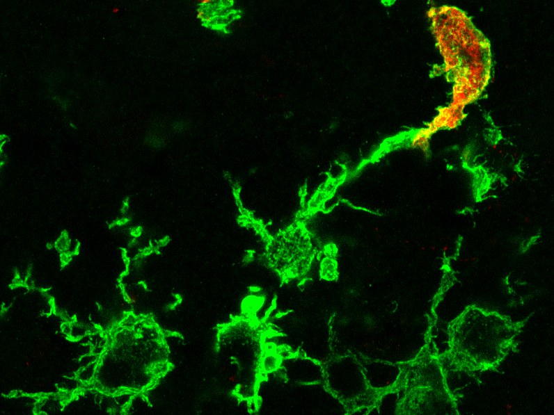 Mikroskopisches Bild von grün angefärbten Makrophagen nach einem Schlaganfall: