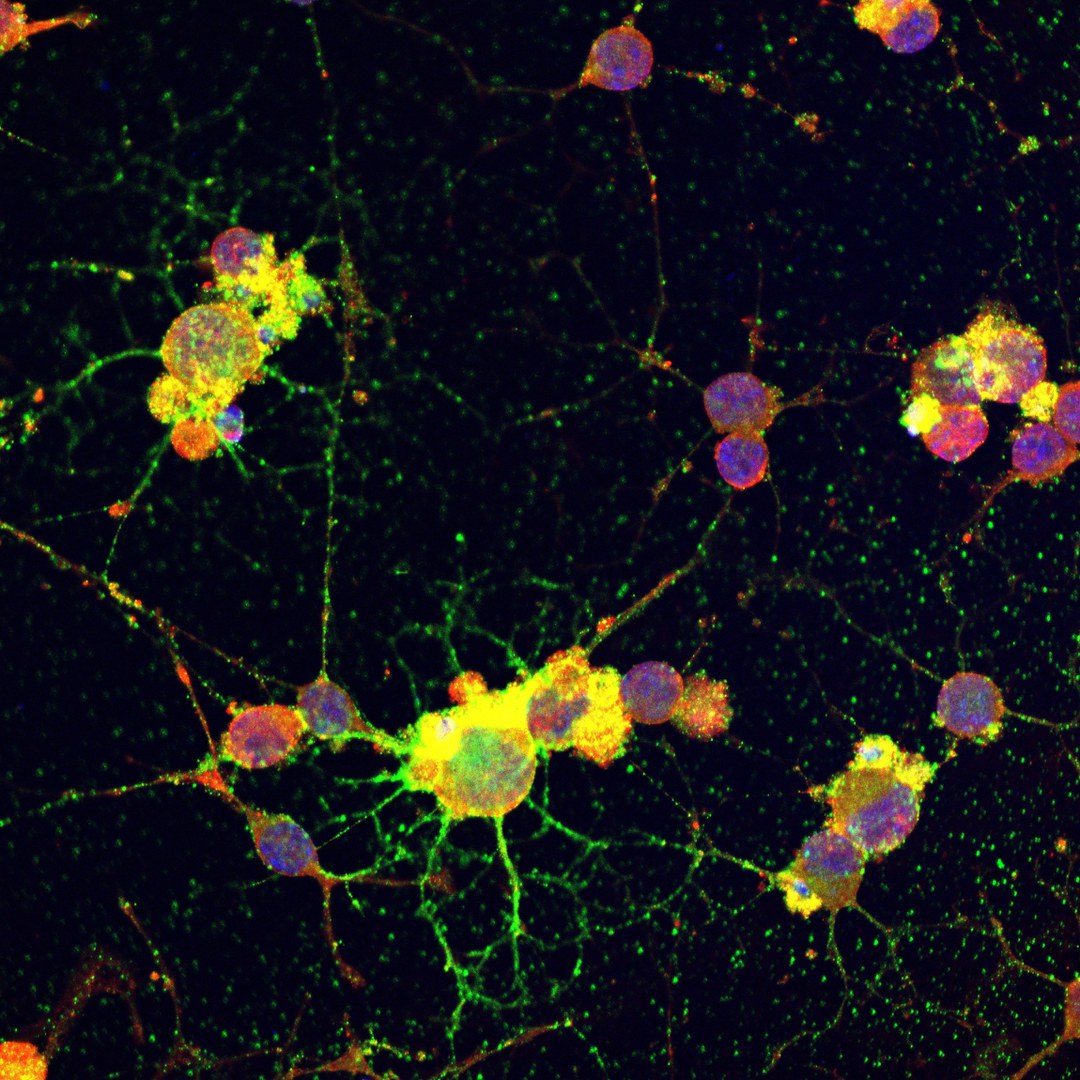 Die Antikörper gegen Casein (rot) binden im Gehirn an MAG (grün). Sie stören dadurch die Bildung von Myelin durch spezielle Zellen, die Oligodendrozyten.