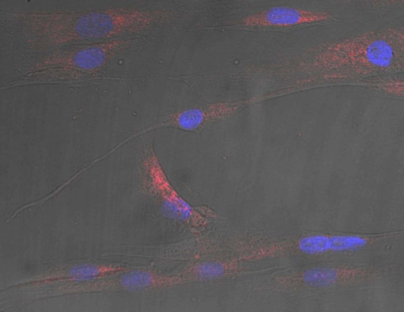 Mikroskopische Aufnahme menschlicher Muskelzellen mit Zellkernen (blau) und Stress, verursacht durch Ceramid-Signale (rot).