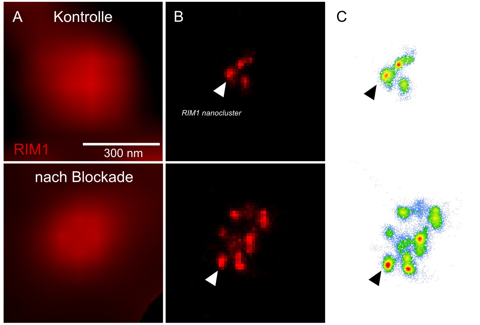 Die Plastizität neuronaler Kommunikation, hervorgerufen durch eine 48-stündige Blockade neuronaler Aktivität, korreliert mit der Anzahl der RIM-Molekülcluster in der aktiven Zone. Spalte A ist aufgenommen mit Weitfeldbeleuchtung; Spalte B ist aufgenommen mit dStorm-Mikroskopie; Spalte C zeigt Molekülcluster.