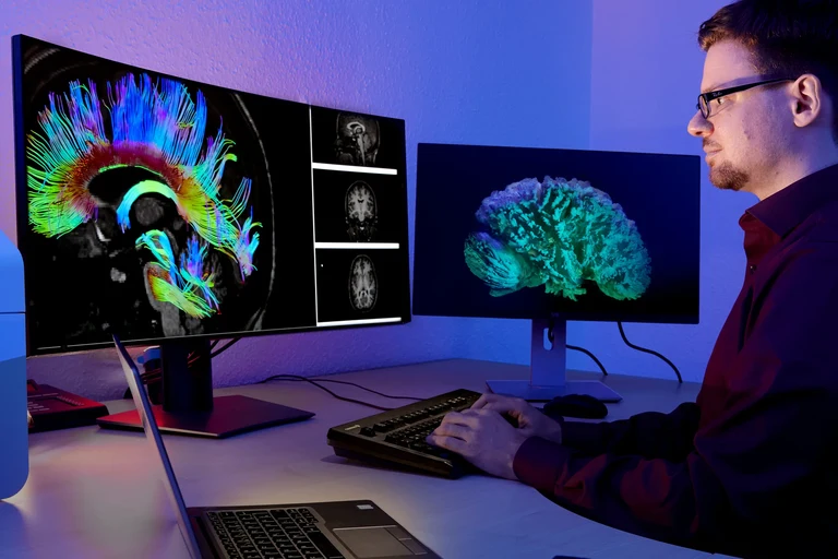 Gruppe "Visualisierung und Medizinische Bildanalyse" am B-IT und Institut für Informatik II der Universität Bonn: