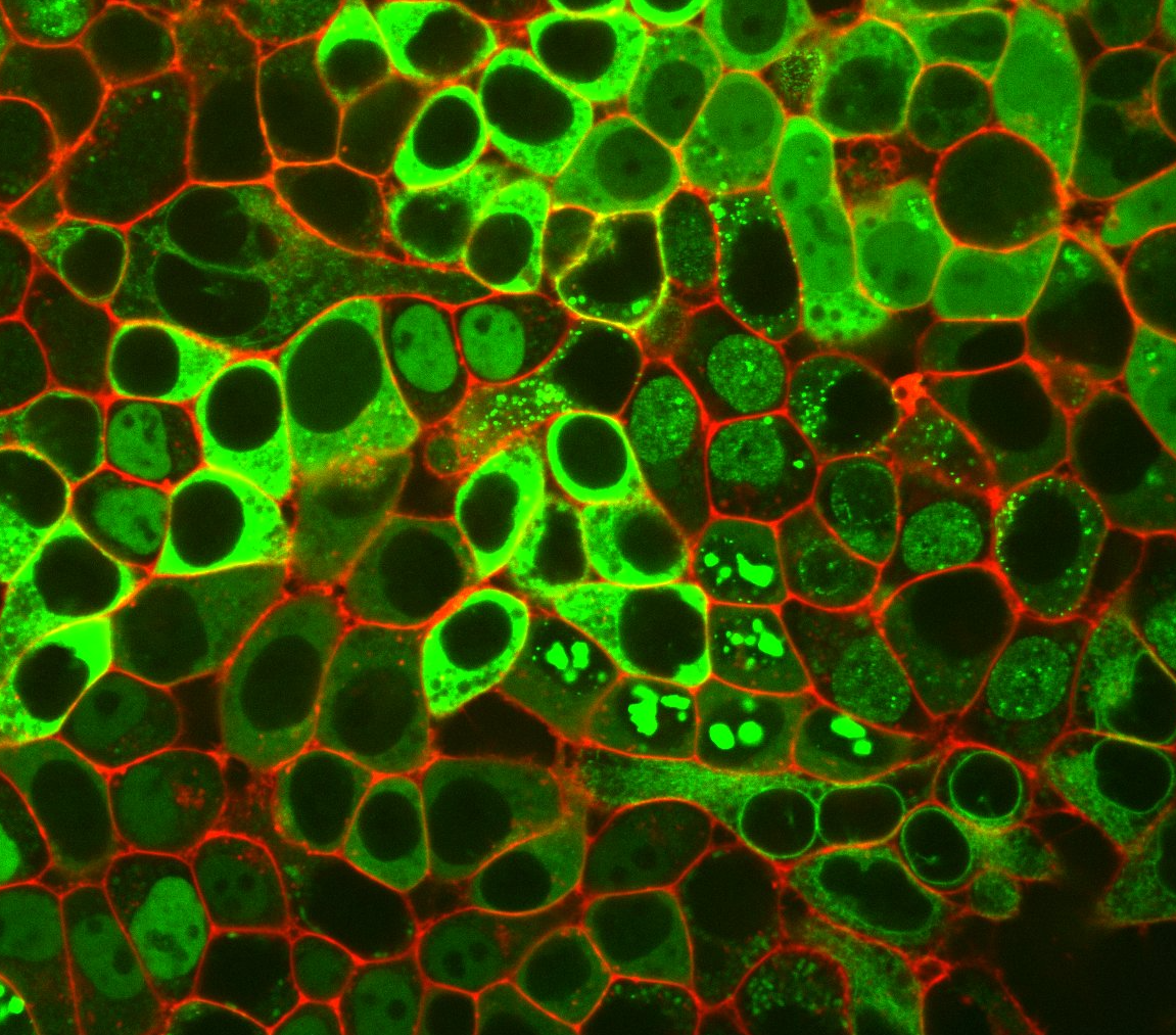 Leuchtende Proteine in menschlichen Zellen: