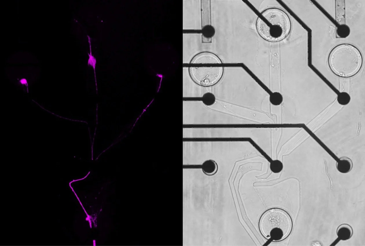 Fluoreszenz- (links) und Hellfeldaufnahme (rechts)