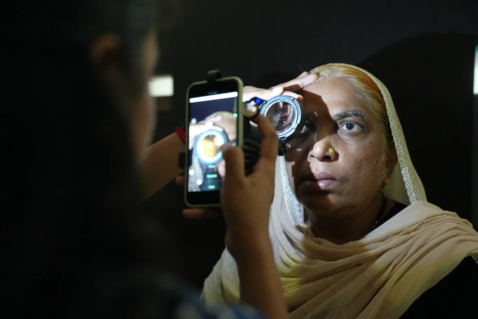 Smartphone-basierte Netzhautbildgebung im praktischen Einsatz in Indien:
