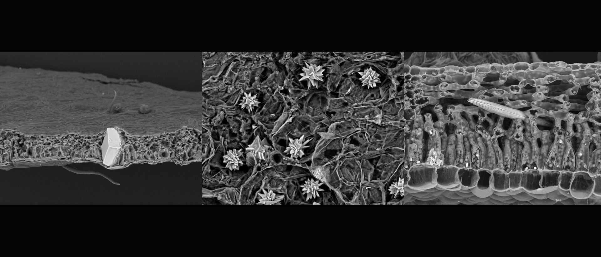 In lebenden Pflanzen können Kalziumoxalat-Kristalle unter dem Mikroskop bizarre Formen annehmen (v. links: Hainbuche, Knopfmangrove, australische Brennnessel)