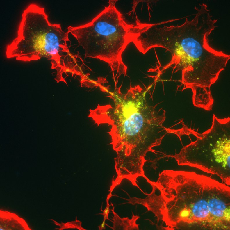 Mikroglia-Zellen