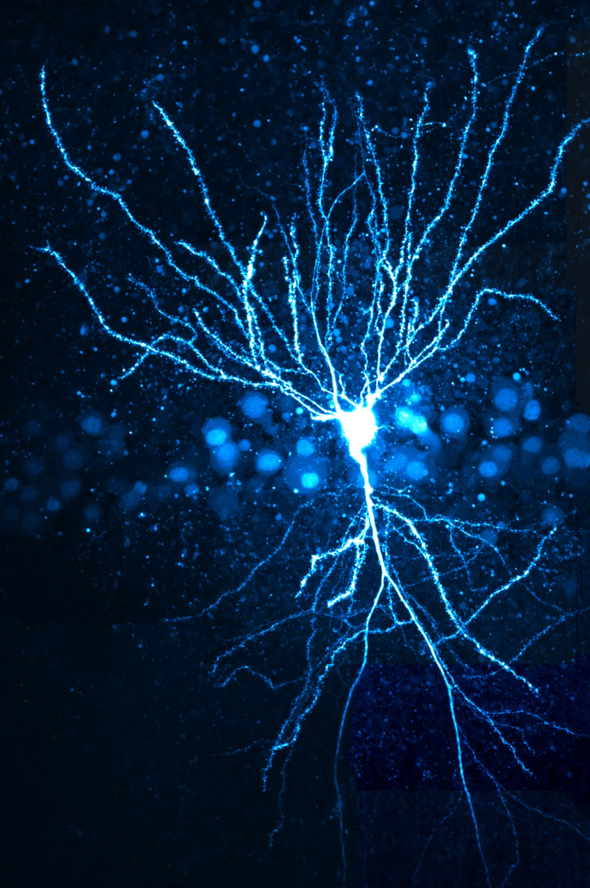 Neue Befunde zu Erinnerungsstörungen bei Epilepsie