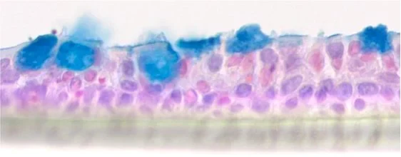 Air liquid interface Kultur von humanen bronchialen Epithelzellen: