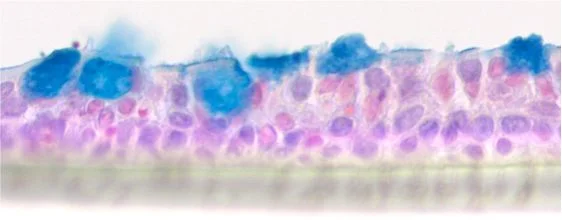 Air liquid interface Kultur von humanen bronchialen Epithelzellen: