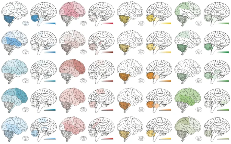 Je nach Lage im Zentralen Nervensystem