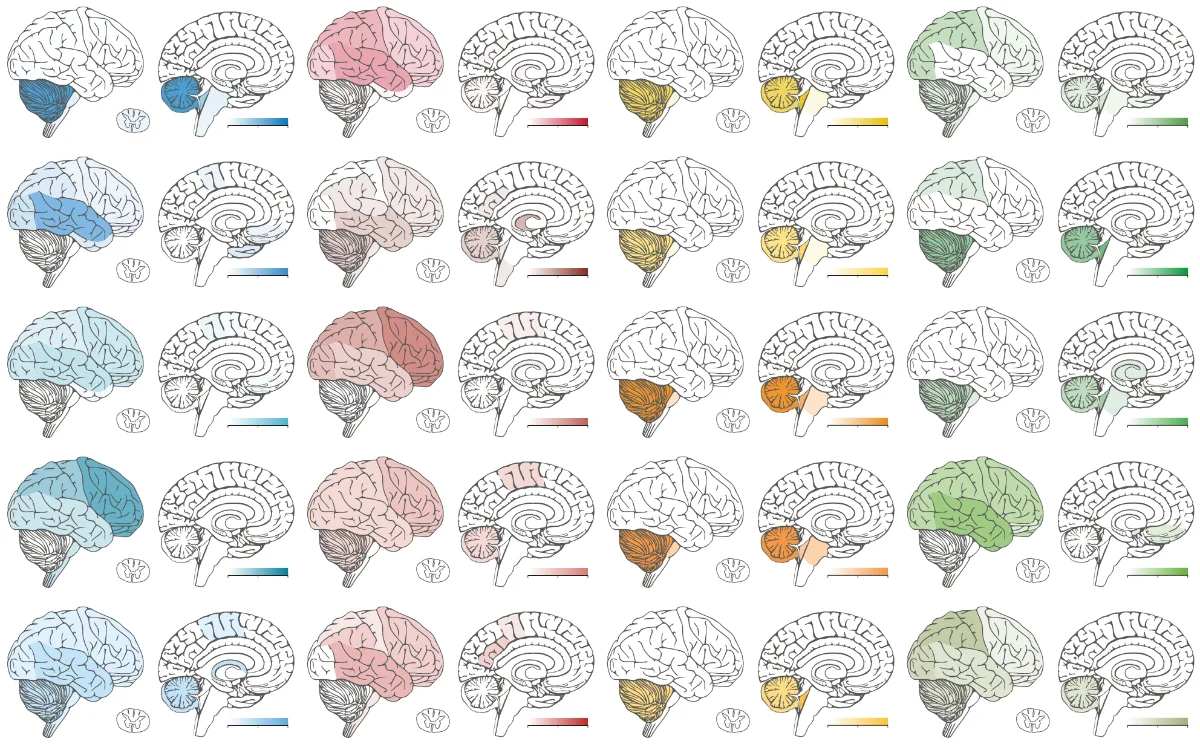 Je nach Lage im Zentralen Nervensystem