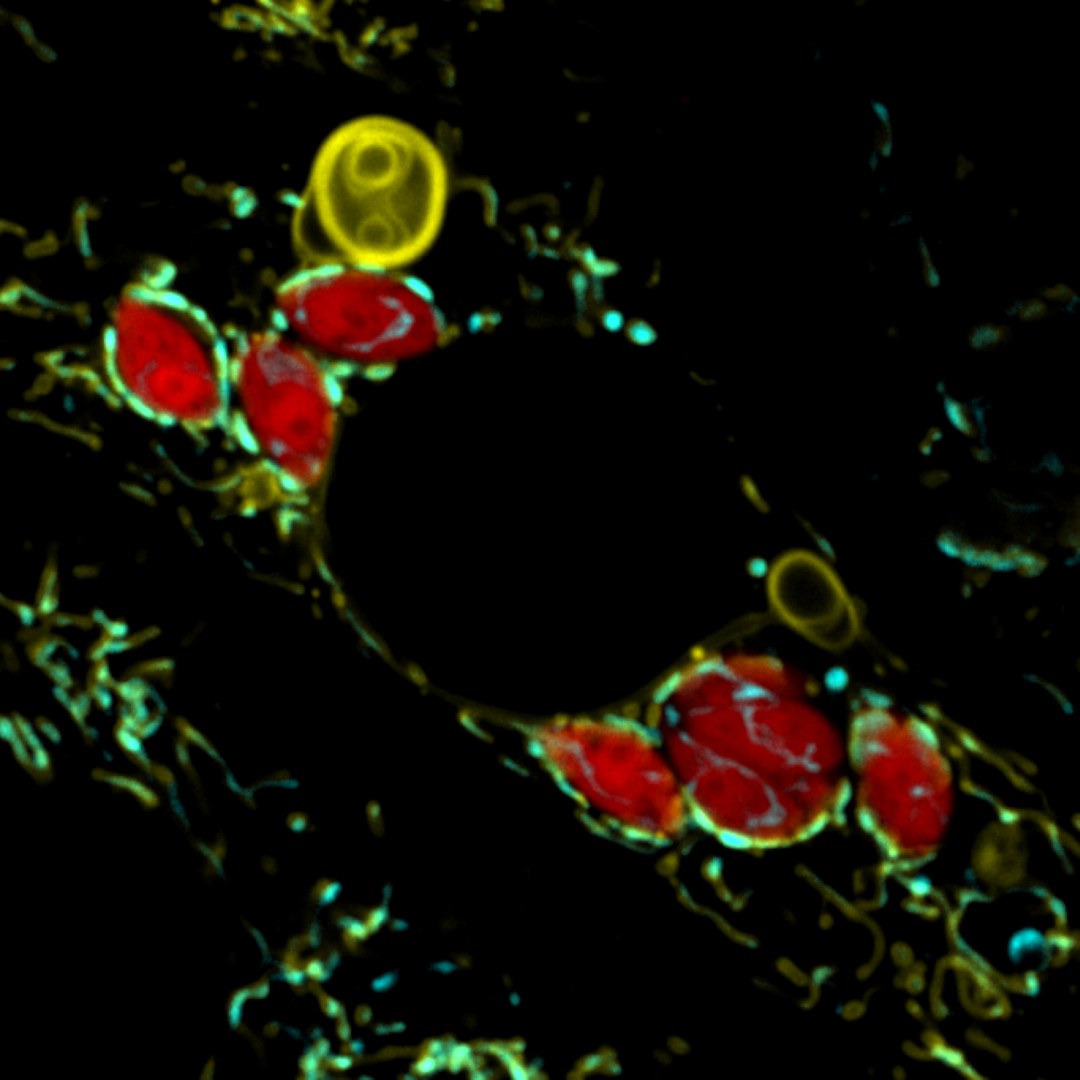 Der Parasit Toxoplasma gondii (rot) bringt die Mitochondrien (grün) dazu große Strukturen ihrer „Haut“ (gelb) abzustoßen.