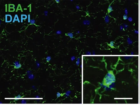 Die Anzahl der Mikrogliazellen
