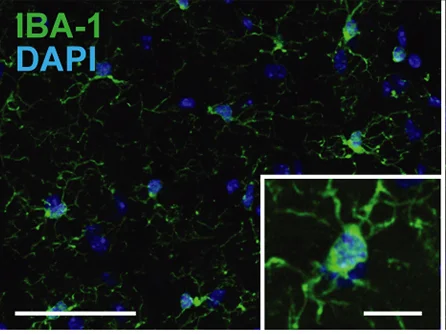 Die Anzahl der Mikrogliazellen