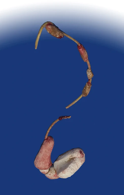 Bild Diamantähnliche Schichten halten Implantate sauber