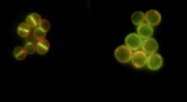 Fluoreszenzmikroskopische Aufnahme: