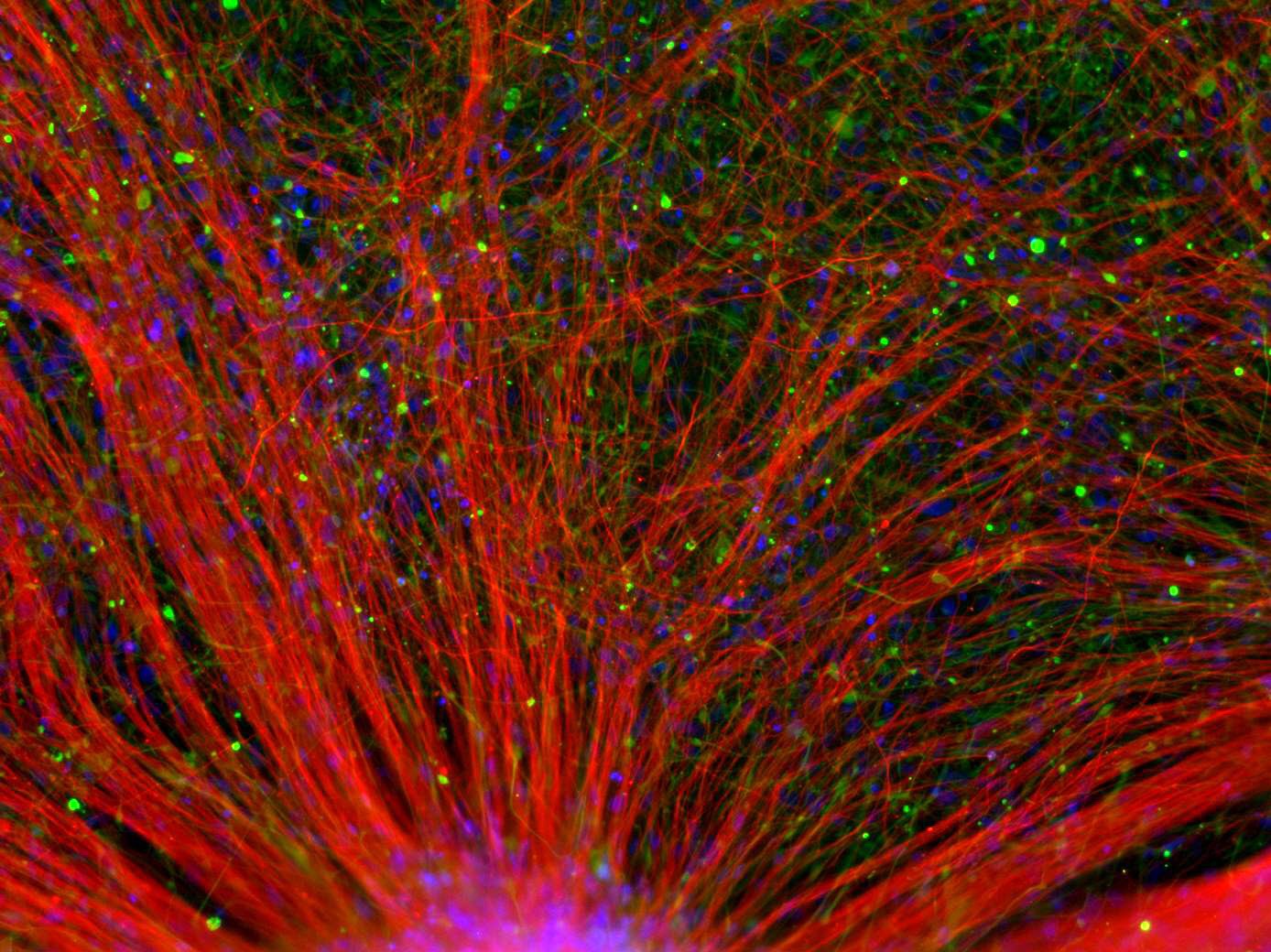 Neurone und Gliazellen aus humanen induziert pluripotenten Stammzellen (iPS-Zellen):