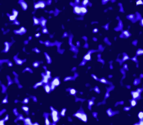 Die Verteilung der Dunklen Materie: