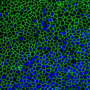 Fluoreszenzmikroskopische Aufnahme