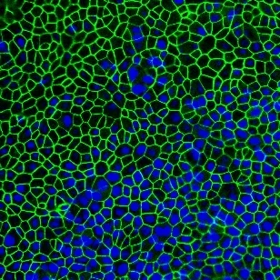 Fluoreszenzmikroskopische Aufnahme