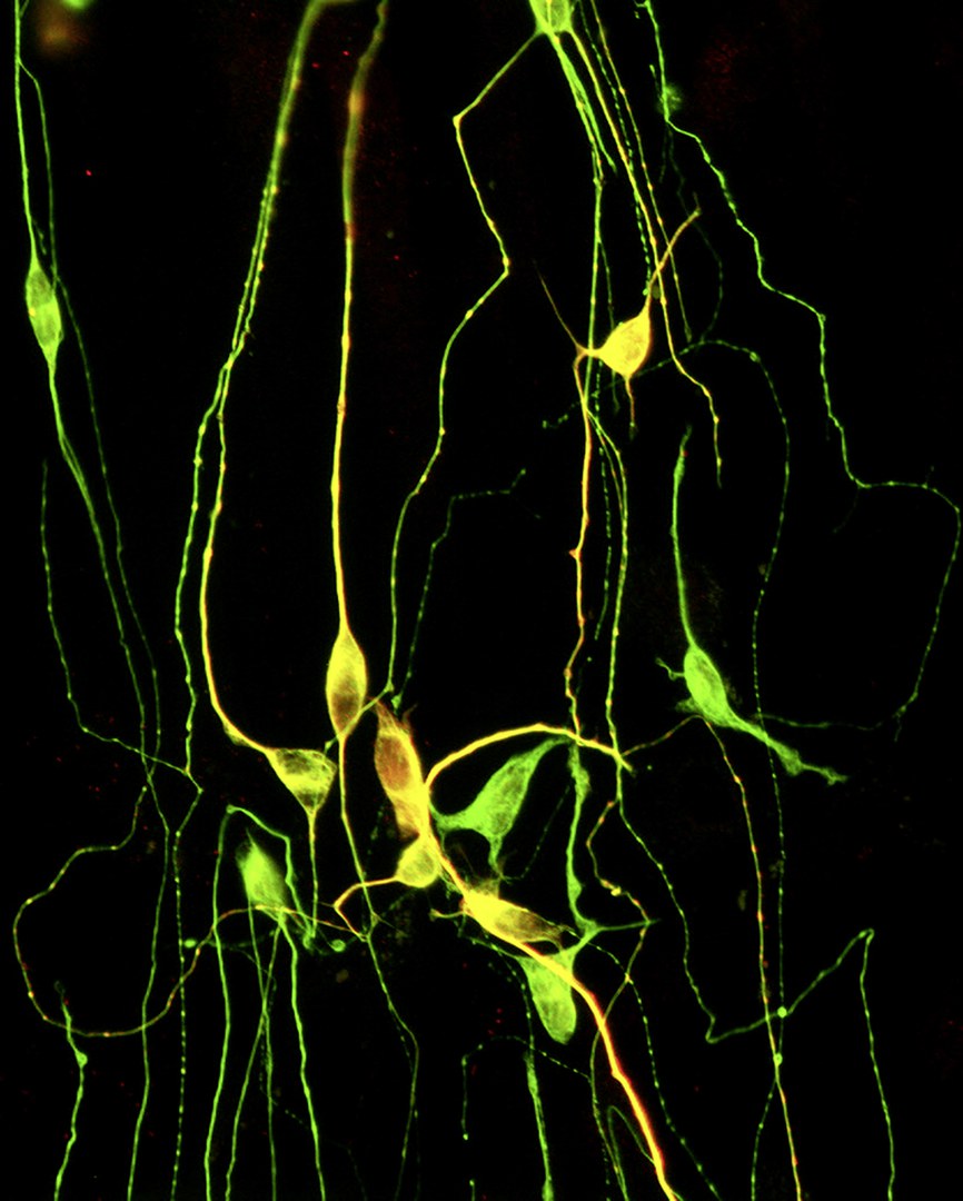 Nervenzellen, die direkt aus Hautzellen gewonnen wurden: