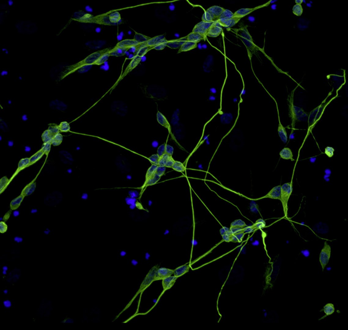 Nervenzellen, die direkt aus Hautzellen hergestellt wurden: