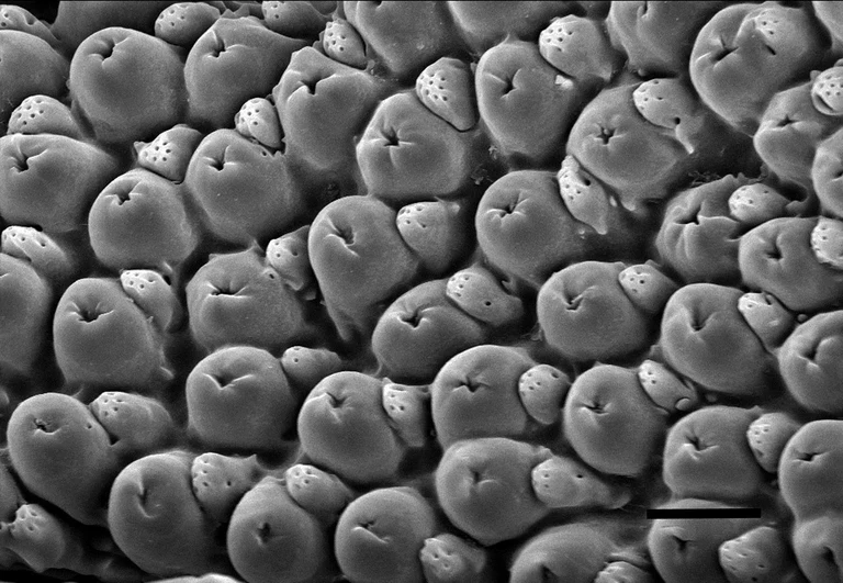 Rasterelektronenmikroskopische Aufnahme