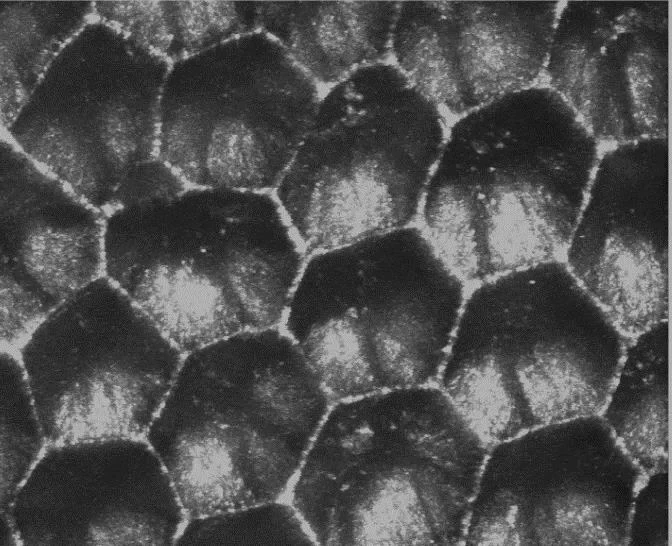 Blick mit dem konfokalen Mikroskop