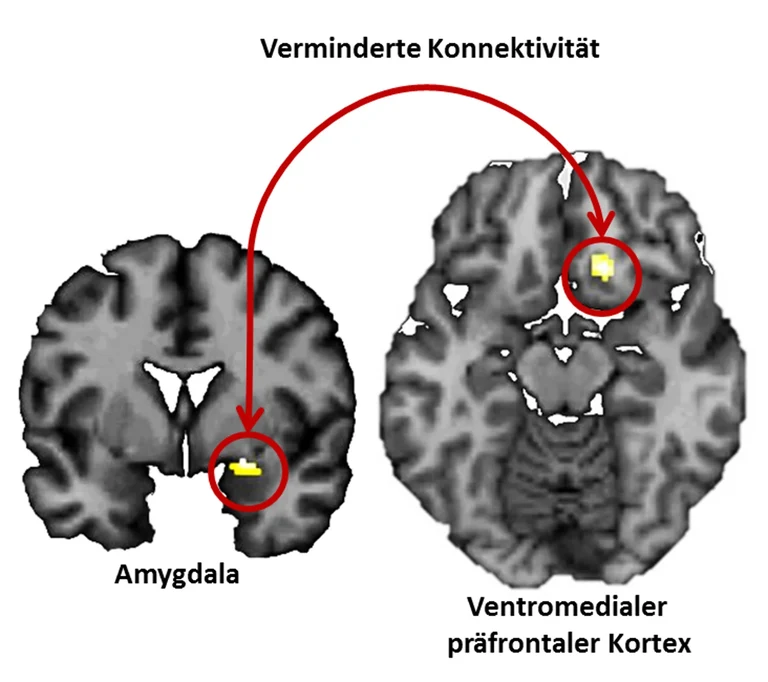 Neuronale Mechanismen der Einprägung negativer Erfahrungen: