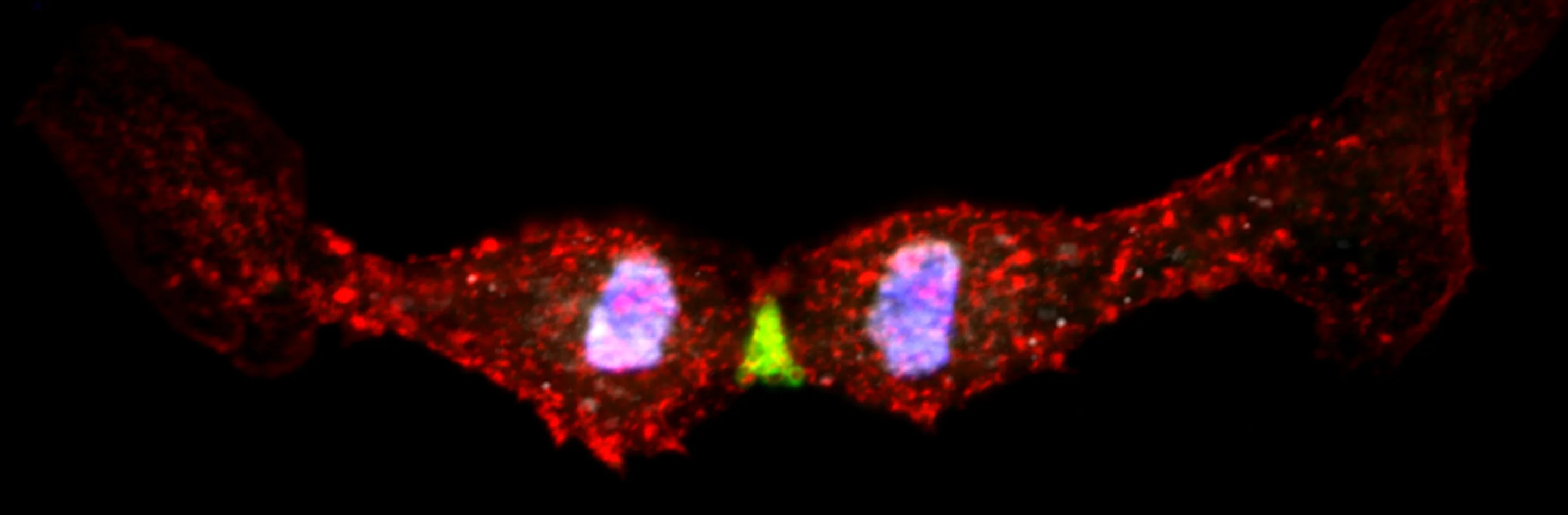 Abbildung einer sich teilenden embryonalen Herzmuskelzelle: