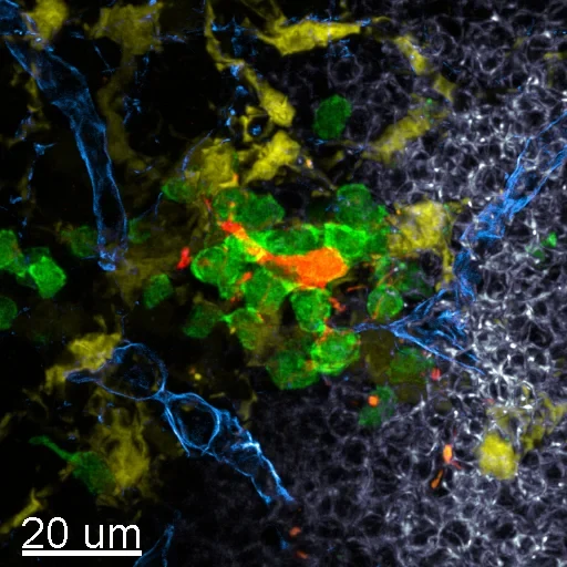 Blick durchs Mikroskop: