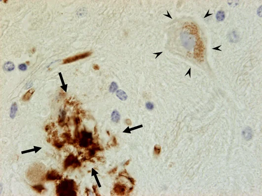 Unter dem Lichtmikroskop: