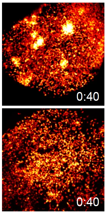 Fluoreszierende Neutrophile