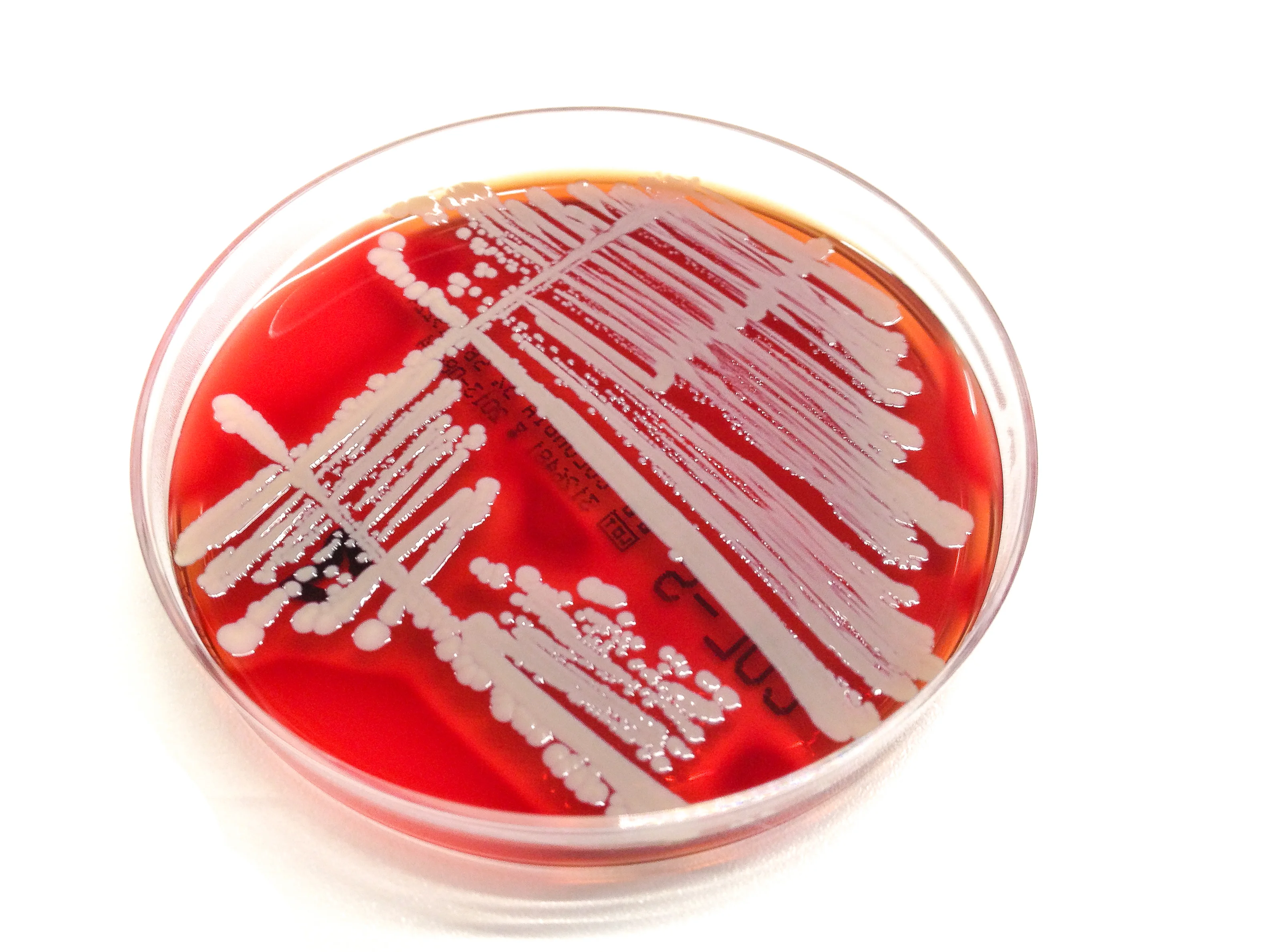 Staphylococcus e coli. Чашка петри с агаром. Микробы стрептококки. Эшерихии картинки. Кишечная палочка колонии на агаре.