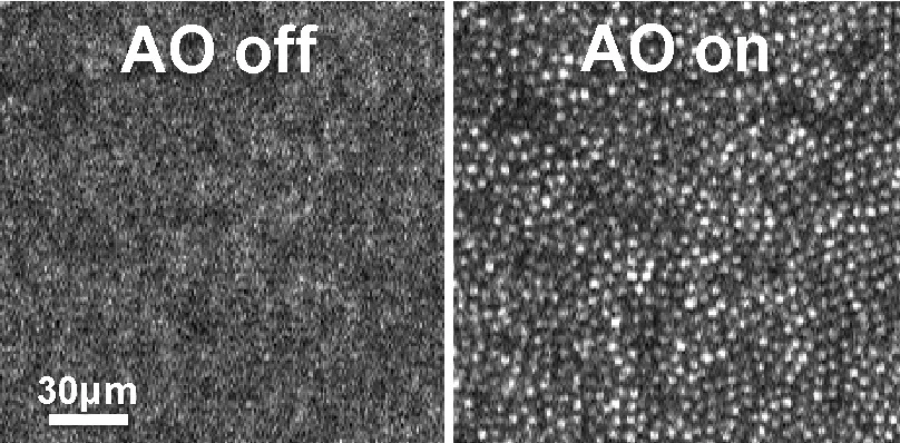 Fotorezeptoren auf der Netzhaut: