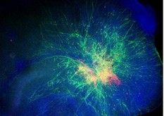 Die Verteilung von Neuronen und Nervenvorläuferzellen