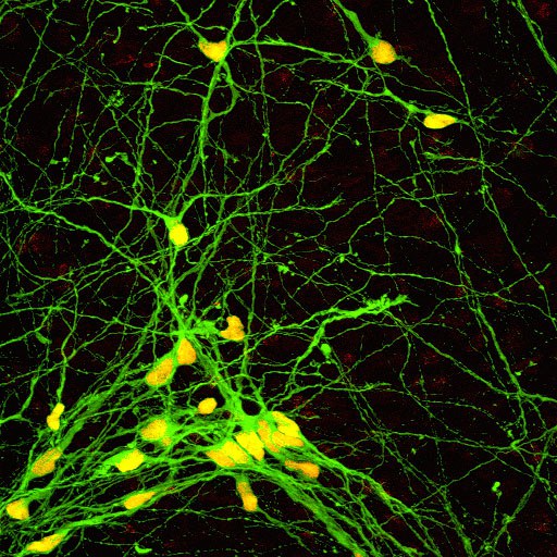 Humane ES-Zell-abgeleitete Neurone.