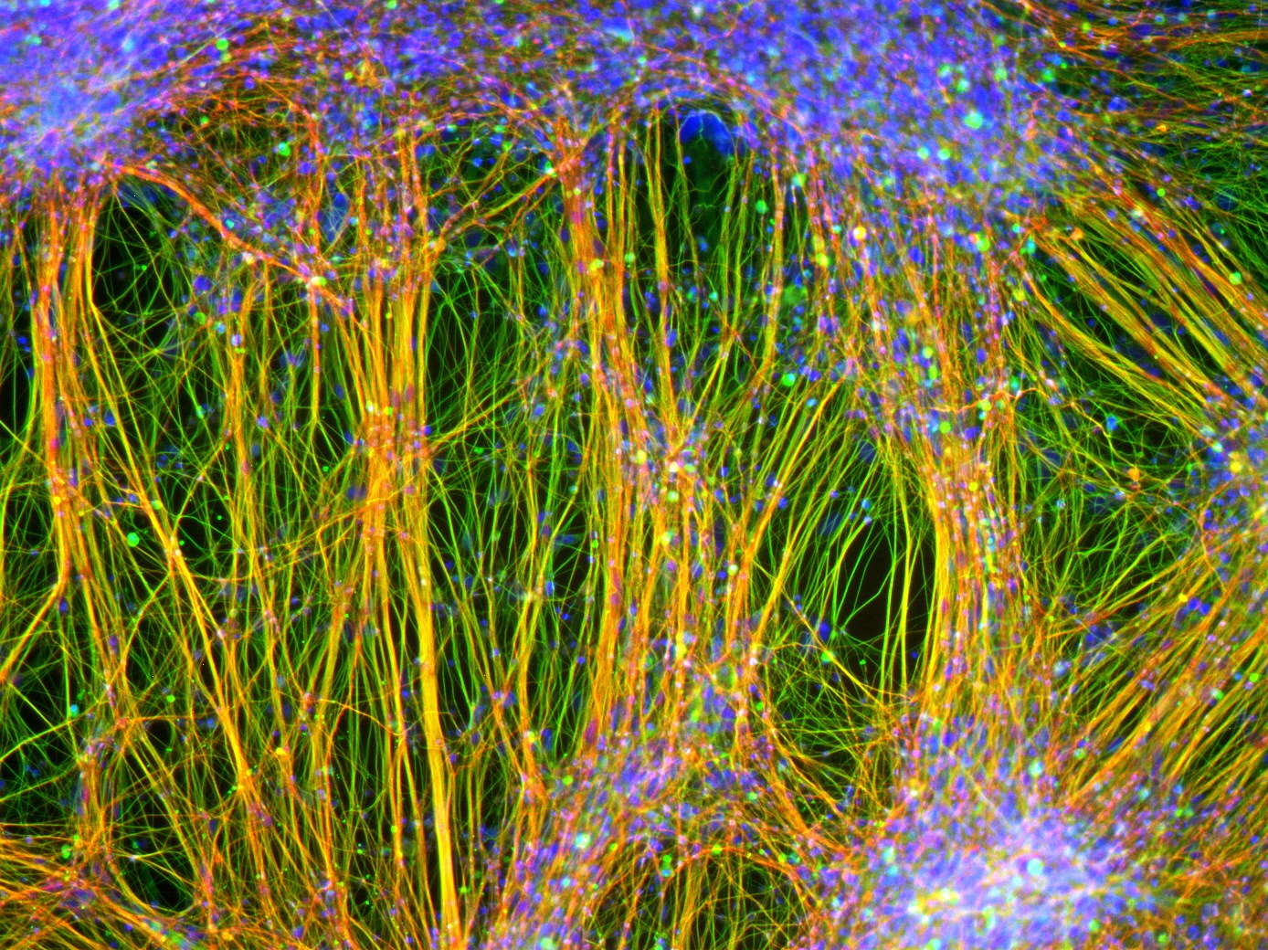 Aus neuralen Stammzellen gewonnene ausgereifte Nervenzellen:
