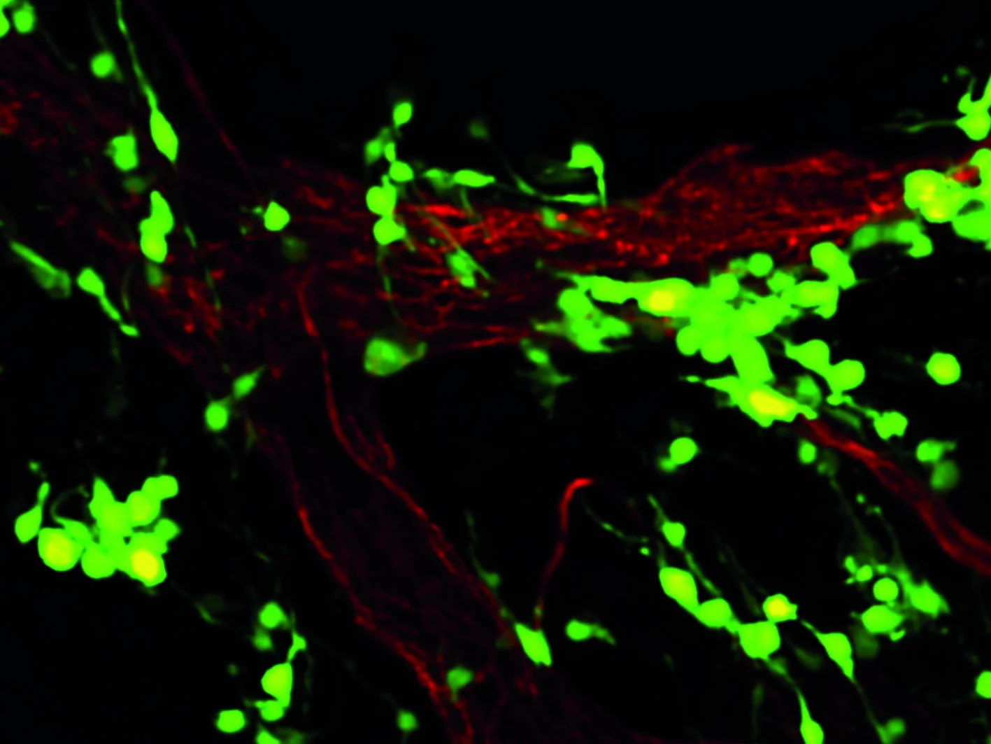 Ausbreitung von Melanomzellen entlang von Blutgefäßoberflächen: