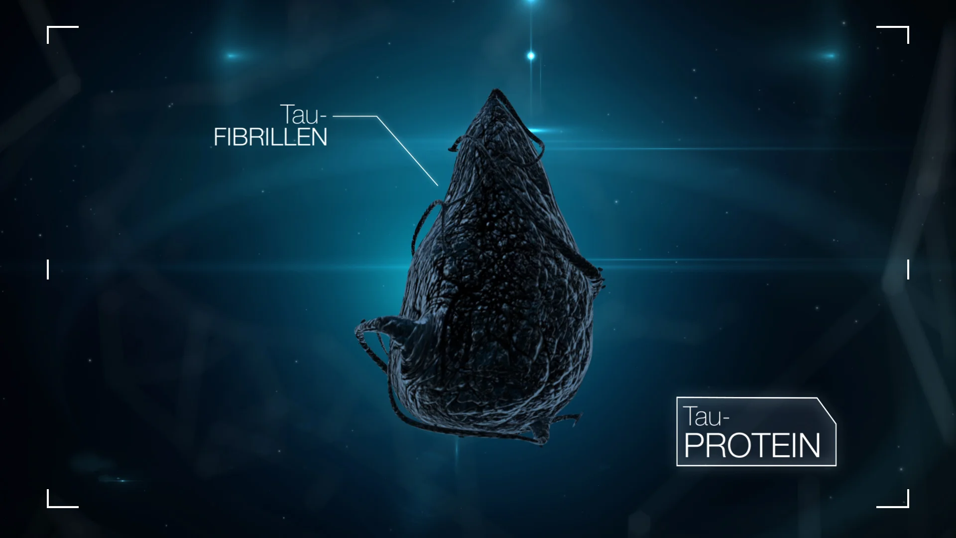 Charakteristisch für die Alzheimer-Krankheit: