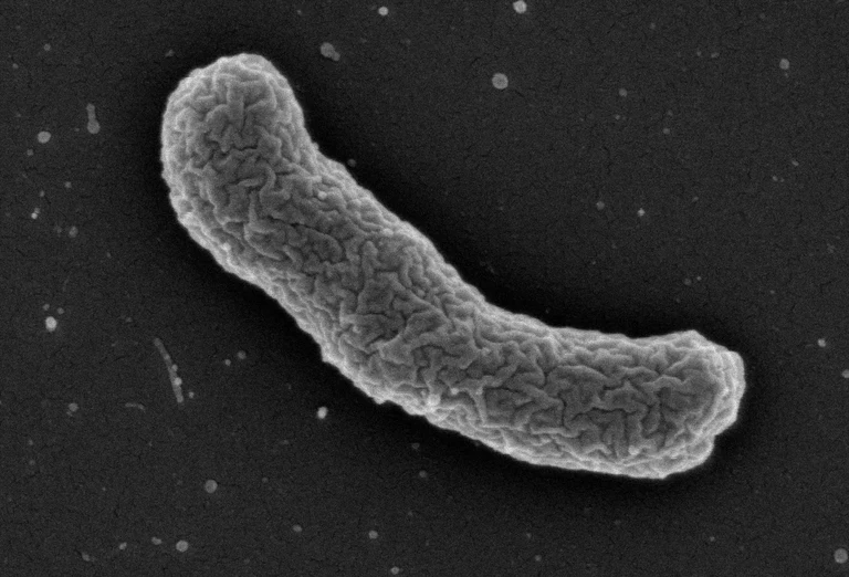 Elektronenmikroskopische Aufnahme