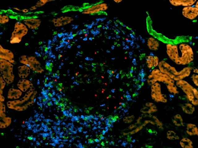 Das Ausschalten von ICOSL
