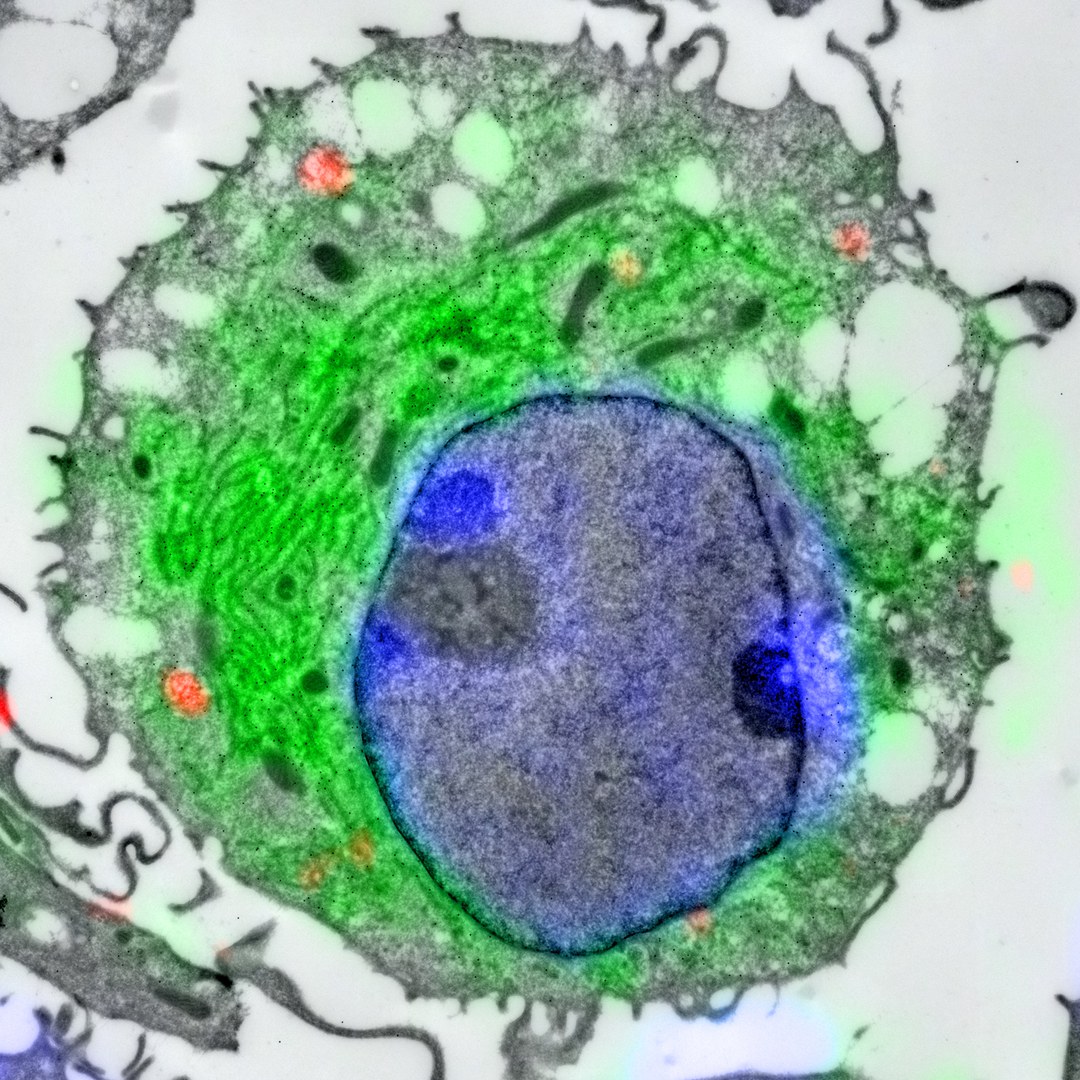 CLEM-Aufnahme (Confocal Laser and Electron Microscopy) einer dendritischen Zelle: