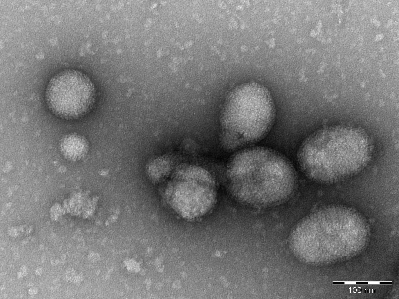 Elektronenmikroskopische Aufnahme des Ferak-Virus: