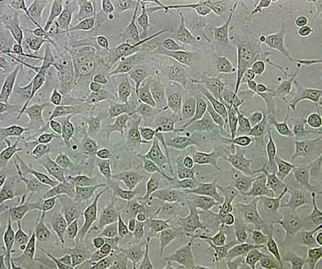 Schwarze Hautkrebszellen: