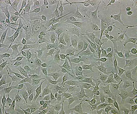 Schwarze Hautkrebszellen: